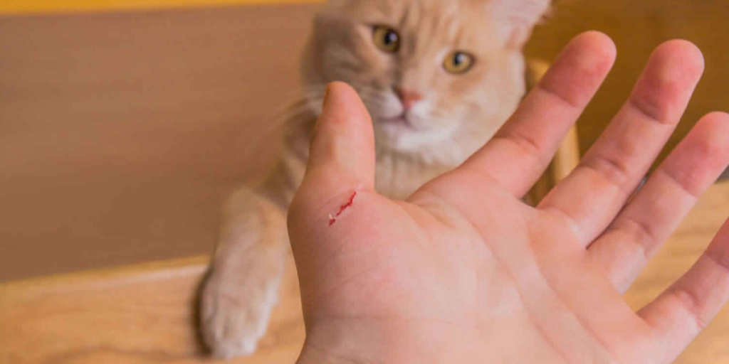 Who’s at Risk for Cat Scratch Fever?